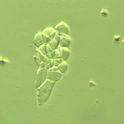 photograph MAGUS HCM360 Device for working with the Hoffman modulation contrast, with objective set,  14