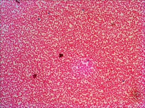 photograph Levenhuk N38 NG Prepared Slides Set,  16