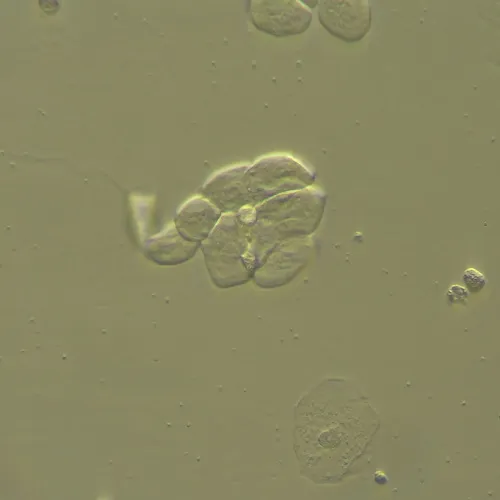 photograph MAGUS HCM360 Device for working with the Hoffman modulation contrast, with objective set,  13