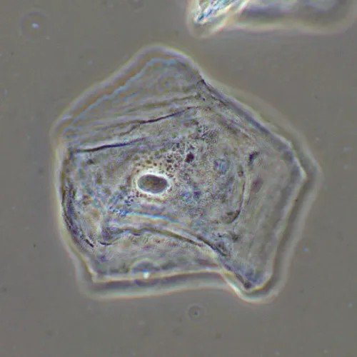 photograph MAGUS SPH2 Phase Сontrast Device,  16