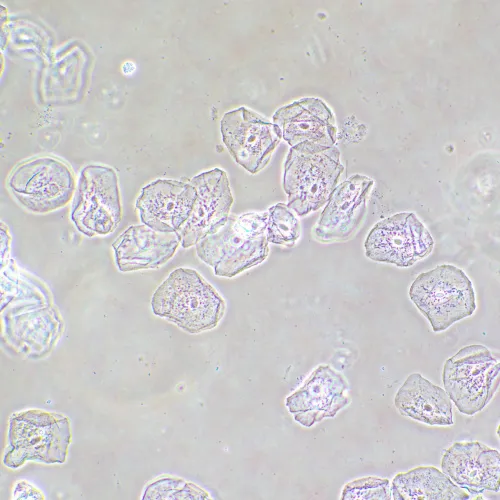 photograph MAGUS SPH2 Phase Сontrast Device,  14